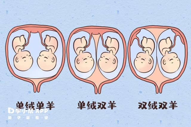 试管双胎是单绒or双绒明白这2点区别轻松判断