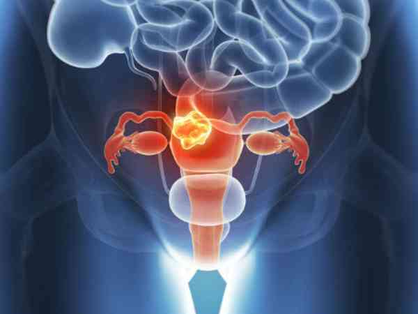 36岁卵巢早衰是否只能做供卵试管,这两点可做参考