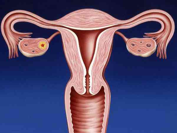 达菲林适宜人群一览，性早熟和子宫内膜异位者一定要看