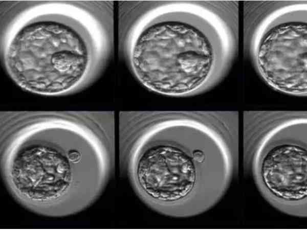 六细胞三级胚能否养囊得看质量，首先了解成功率最重要