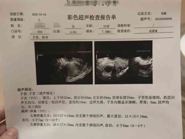 子宫内膜4.2mm处于月经这个阶段，来看看不来姨妈正不正常