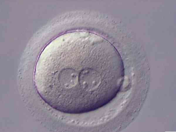 造成3pn胚胎原因并不少，精子和卵子可能都有问题