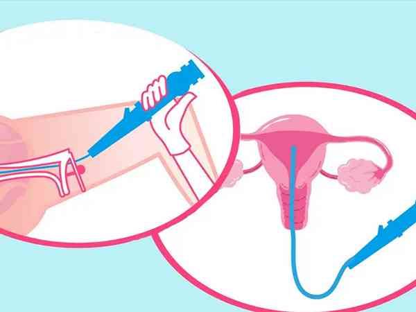长春宫腔粘连医院指引，2024试管助孕、手术诊疗指南
