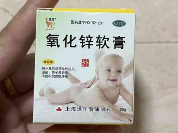 3个月的宝宝能用抹氧化锌，可涂部位80%的家长都不知！