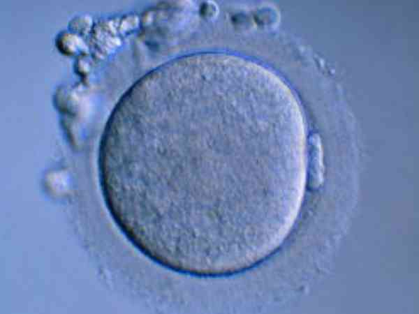 做试管空卵泡的雌激素会有变化，雌二醇低并非是空卵！