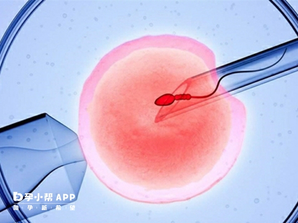 胚胎有三种移植方式