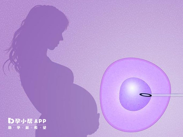 供精人工授精是一种辅助生殖技术