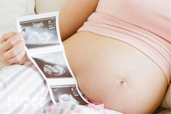 孕期产检做二维对女性有好处