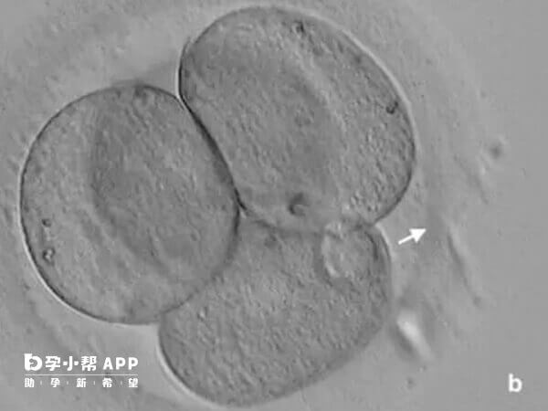 电镜下胚胎的表现