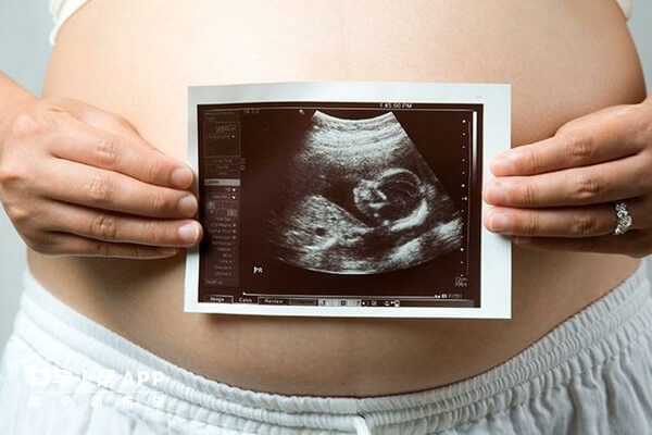 超声波扫描可以检查胎儿性别