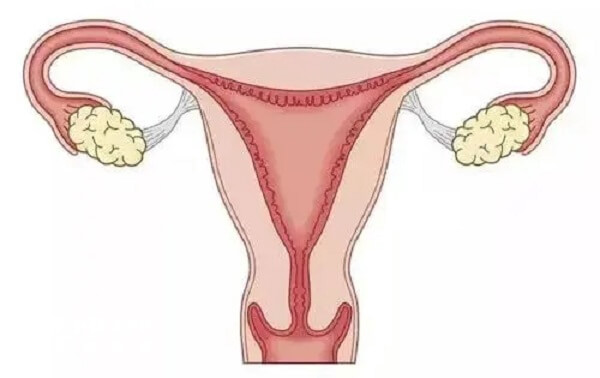 为防止子宫癌变可服用地屈孕酮