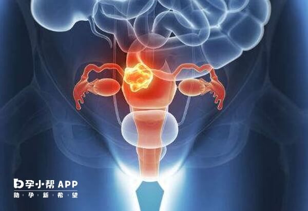 卵巢早衰影响女性健康