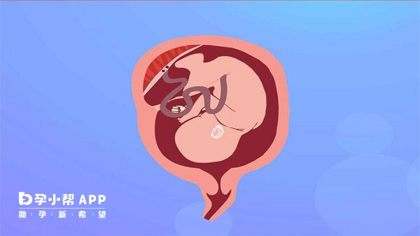 胎盘能够分泌绒促性素