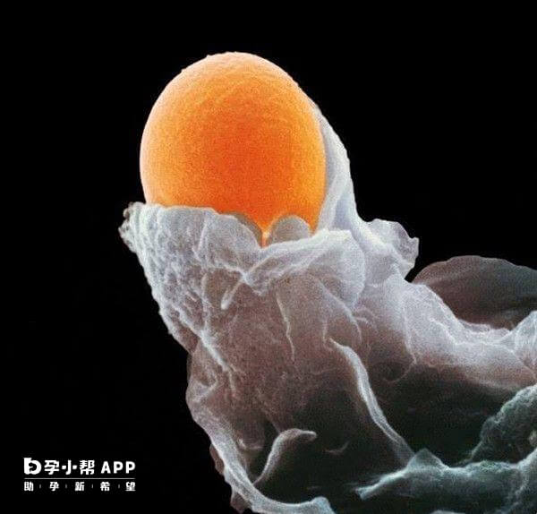 卵泡从卵巢上破裂排出
