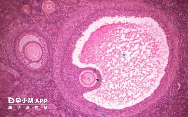 科普 什么卵泡破裂