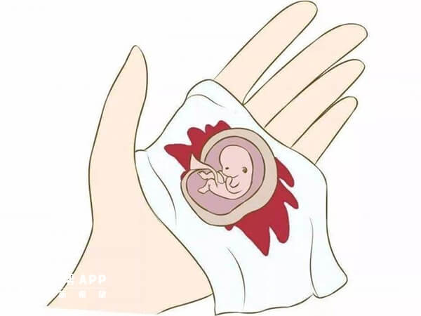 流产后孕者可服用保胎灵片保胎