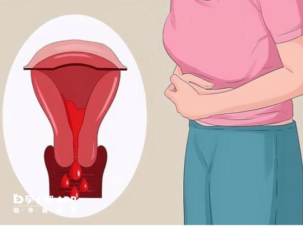 卵泡发育不好会影响怀孕