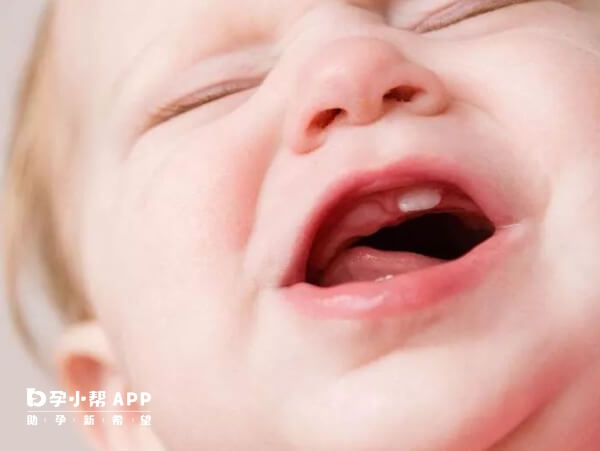 宝宝过早长牙是正常的