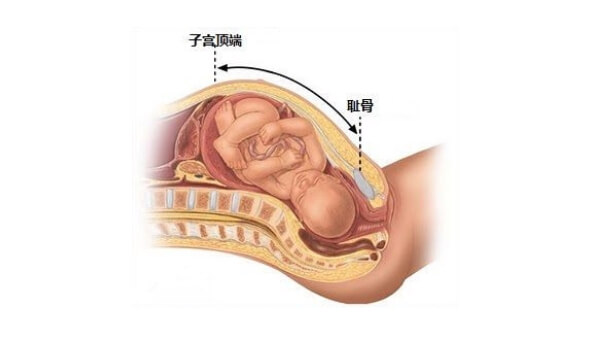 28岁孕妇的耻骨位置分析图是什么样?