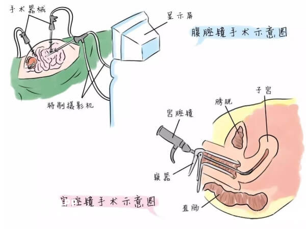 腹腔镜手术消毒顺序图图片