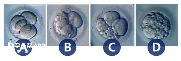胚胎的等级划分