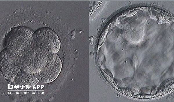 4ab囊胚是优质胚胎