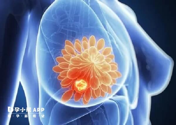 乳腺癌可用乙烯雌酚进行治疗