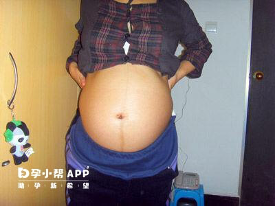 生女儿的妊娠线如图