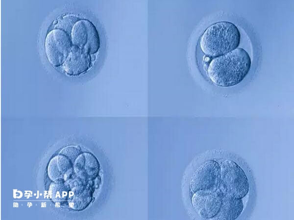 囊胚等级分为三级