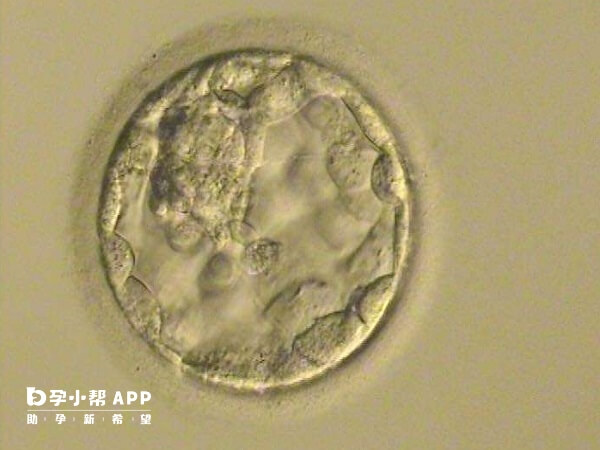 4bb囊胚图片