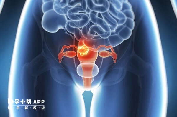女性性腺位置图片