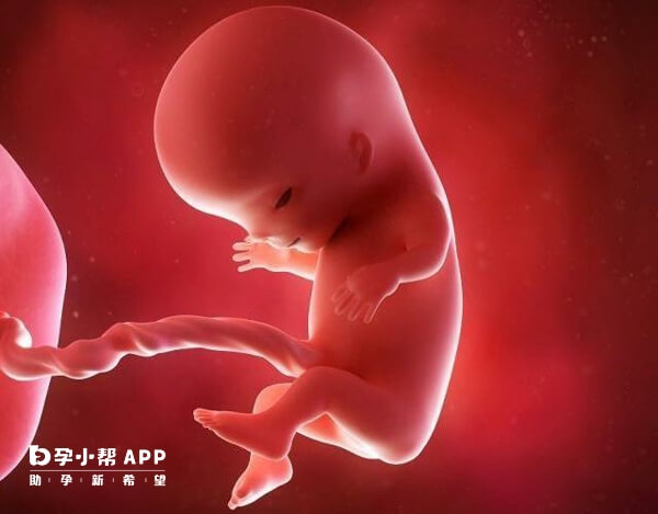 胎儿憋尿会导致双侧肾盂分离