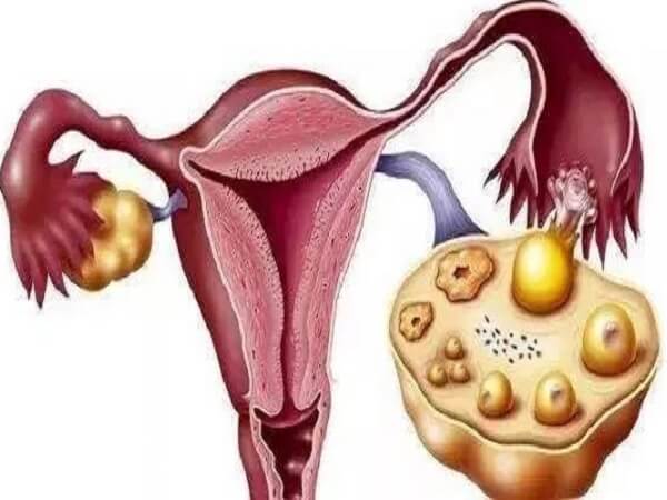 卵巢功能下降可通过饮食改善