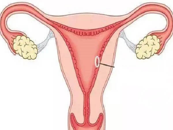 子宫偏小经量和内膜正常可以怀孕