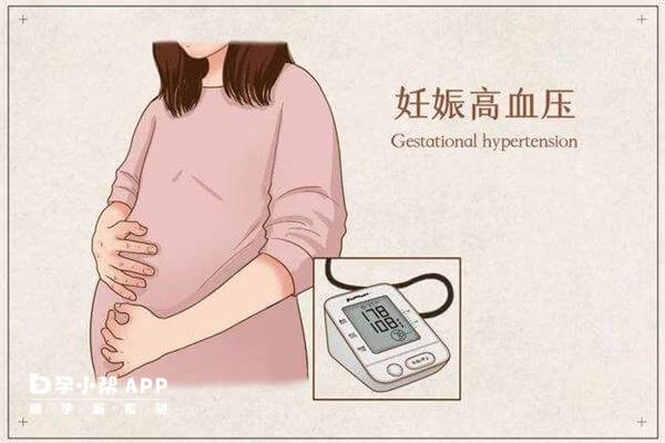 双胎妊娠容易引起妊娠期高血压疾病