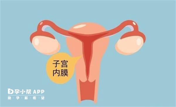 宫腔灌注可以使得子宫内膜增殖