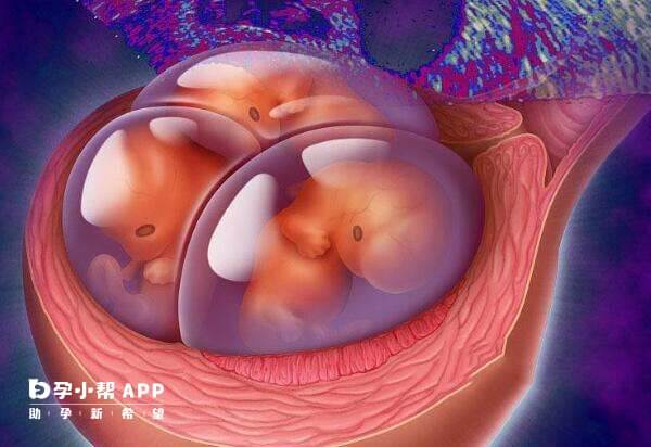 三胞胎减胎最佳时间在孕8-12周