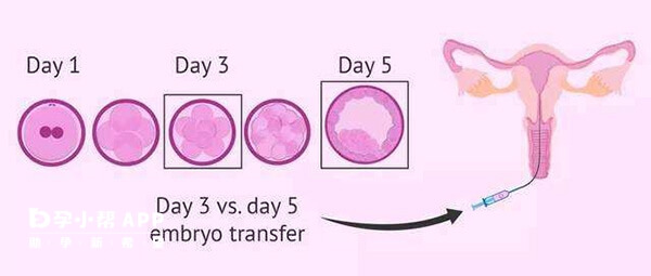 移植同时放2个胚胎的条件