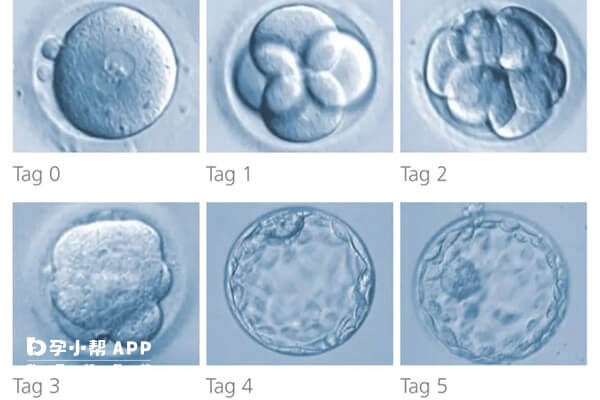 精子和卵子体外培养发育过程
