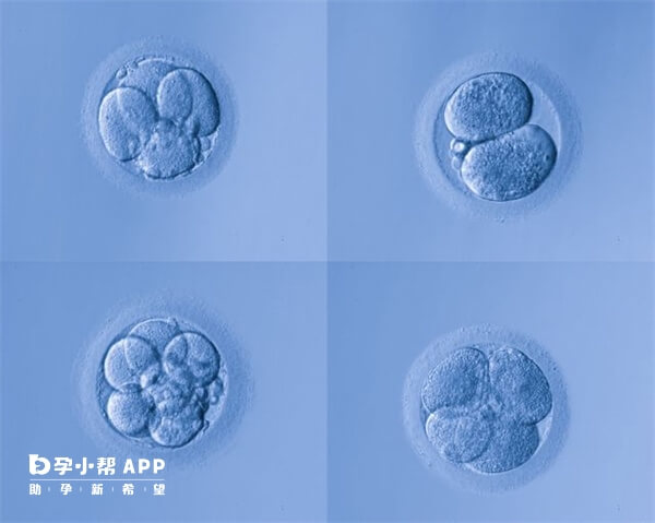 培育后一次植入2-3枚胚胎