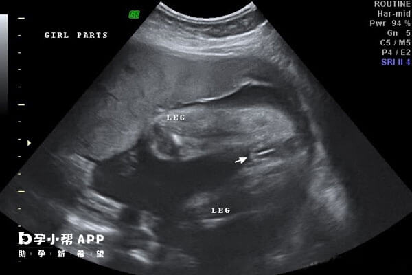 16周胎儿大小真实图片图片