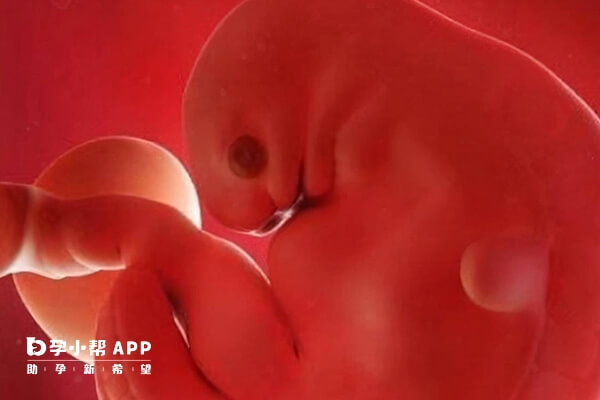孕囊形状与胎儿性别关系不大