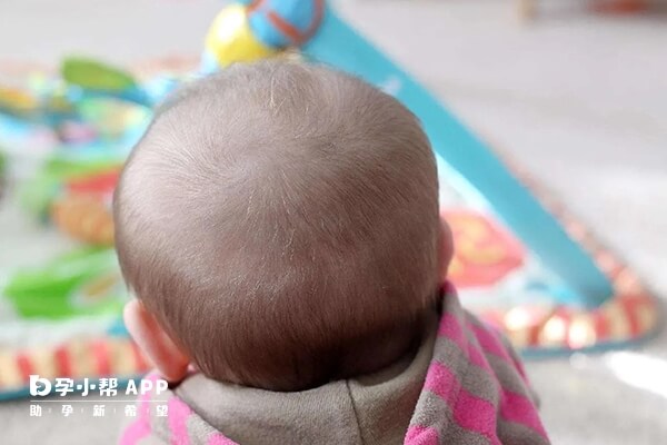 头胎发旋很正代表二胎可能生女宝