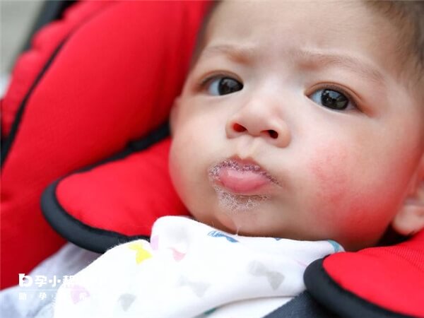宝宝口吐白沫伴有发烧可能患肺炎