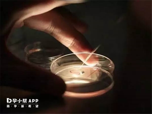 杭州试管报销 杭州供卵试管婴儿医院排名 ‘b超怀男孩的图片’