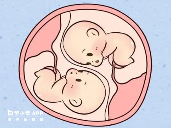 早产双胞胎体重5斤不用进保温箱