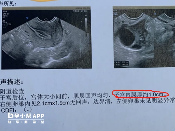 子宫内膜1.0cm