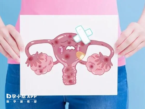 输卵管上举严重的女性建议做试管婴儿