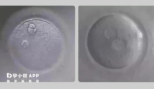 0pn胚胎可能会存活