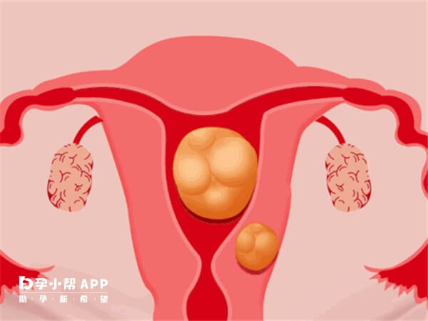 子宫动脉血反向影响胚胎着床